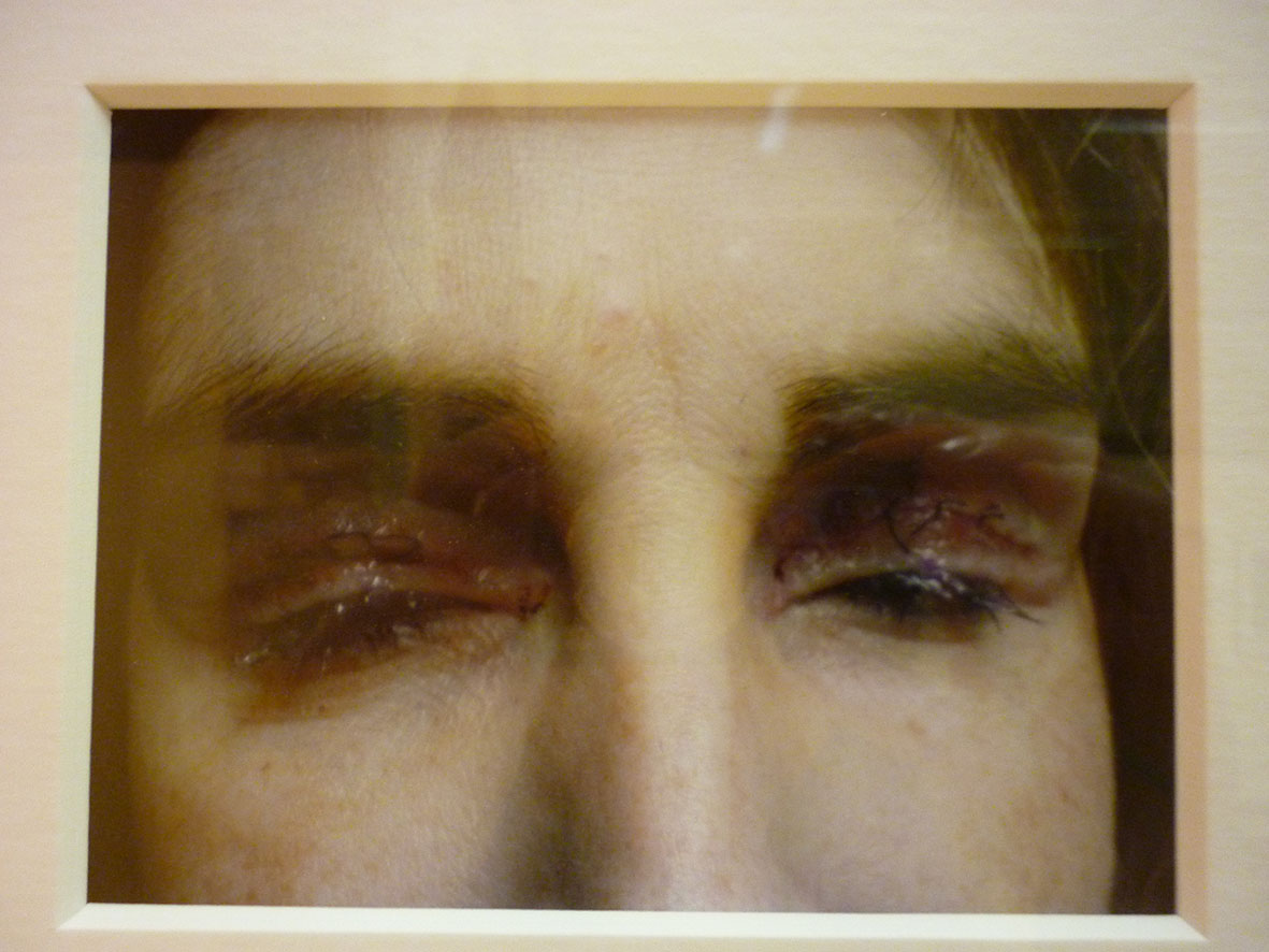 Susan's Eyes (closed) (2008)